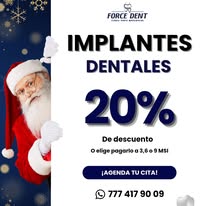 Promoción implantes dentales 20%