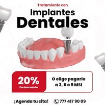 Tratamiento con implantes dentales